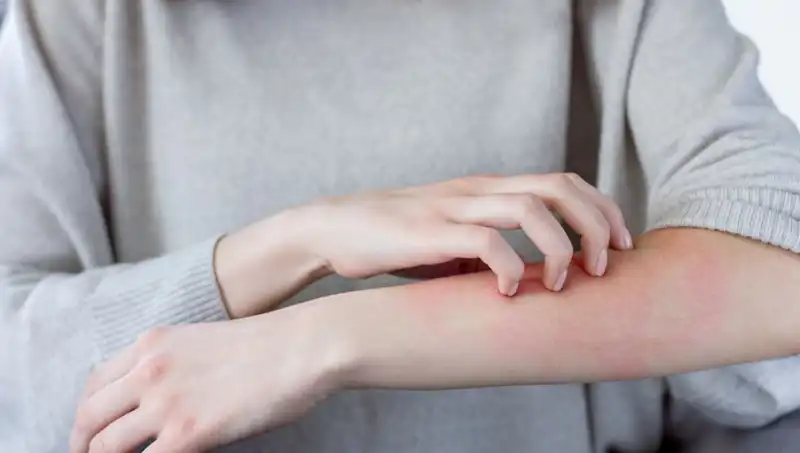 Cilt Kanseri Tehlikesi: Dermatologdan Gözden Kaçırılan İki Belirti Açıklaması