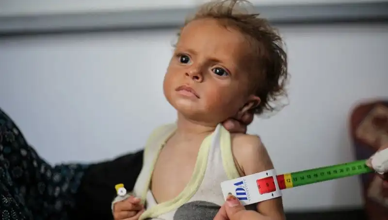 İngiltere, 300 Gazzeli Çocuğa Yeni Bir Gelecek Sunma Kararı Aldı