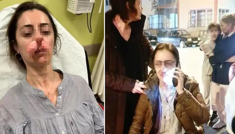 Eşinin Sevgilisine Yanlışlıkla Şiddet Uygulayan Adam: Otomobil Kapısı Silah Sayıldı!